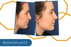 WhatsApp-Image-2022-05-25-at-17.53.52-3