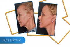 WhatsApp-Image-2022-05-25-at-17.55.35