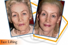 WhatsApp-Image-2022-05-25-at-17.58.07-3